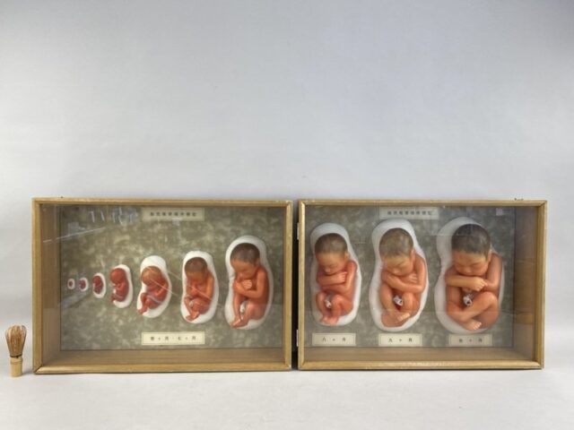 京都科学 胎児発育順序模型 1～10ヶ月 ガラスケース入